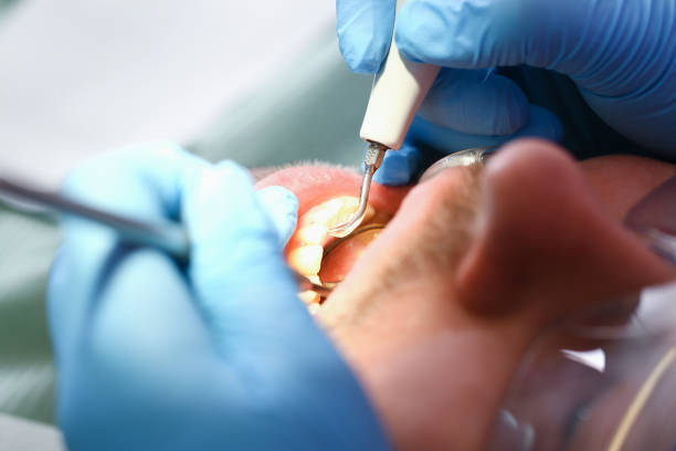 Best Pediatric Emergency Dentist in Little River Academy, TX