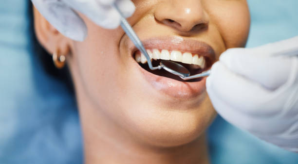 Best Emergency Broken Tooth Repair in Little River Academy, TX